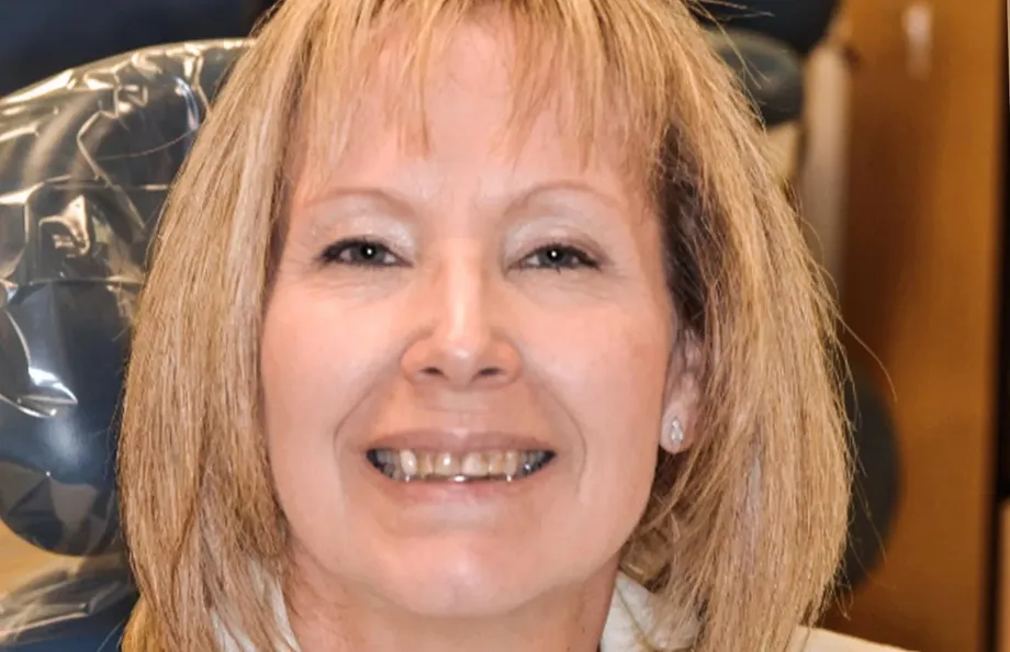 Tamara before her dental treatment