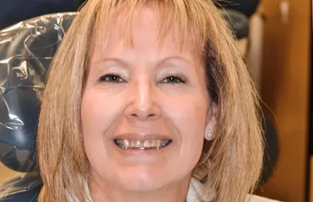 Tamara before her dental treatment