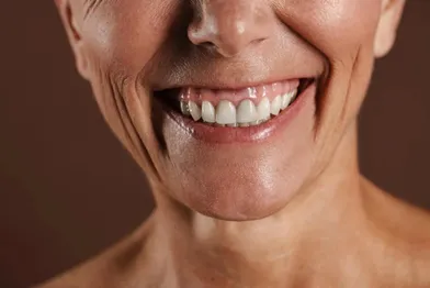 An elderly woman smiling with her dentures.